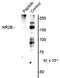 Glutamate receptor ionotropic, NMDA 2B antibody, PA5-35401, Invitrogen Antibodies, Western Blot image 