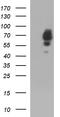 Sterol Carrier Protein 2 antibody, M02947, Boster Biological Technology, Western Blot image 