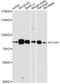 Coagulation factor XIII A chain antibody, STJ29855, St John