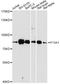 Coagulation Factor XIII A Chain antibody, STJ29855, St John