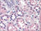 Phosphoenolpyruvate carboxylase antibody, AP22519PU-N, Origene, Immunohistochemistry frozen image 