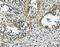Vinculin antibody, A01207-1, Boster Biological Technology, Immunohistochemistry paraffin image 