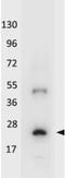 AKT Serine/Threonine Kinase 2 antibody, orb345015, Biorbyt, Western Blot image 