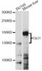 GLI Family Zinc Finger 1 antibody, A8387, ABclonal Technology, Western Blot image 
