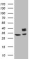 Succinate Dehydrogenase Complex Iron Sulfur Subunit B antibody, MA5-26936, Invitrogen Antibodies, Western Blot image 