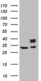 Succinate Dehydrogenase Complex Iron Sulfur Subunit B antibody, MA5-26936, Invitrogen Antibodies, Western Blot image 