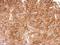 TCP-1 antibody, LS-C185461, Lifespan Biosciences, Immunohistochemistry paraffin image 