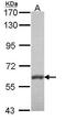 Membrane Palmitoylated Protein 6 antibody, PA5-21889, Invitrogen Antibodies, Western Blot image 