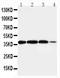 Arginase 2 antibody, LS-C312947, Lifespan Biosciences, Western Blot image 