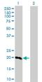 Surfactant Protein C antibody, H00006440-D01P, Novus Biologicals, Western Blot image 