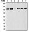 Nuclear Factor Kappa B Subunit 1 antibody, LS-C352572, Lifespan Biosciences, Western Blot image 
