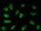 TRNA Aspartic Acid Methyltransferase 1 antibody, 101611-T02, Sino Biological, Immunohistochemistry paraffin image 