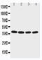 Eukaryotic Translation Initiation Factor 2 Subunit Beta antibody, LS-C313266, Lifespan Biosciences, Western Blot image 