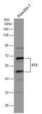 Interleukin 1 Receptor Like 1 antibody, GTX106204, GeneTex, Western Blot image 