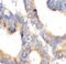 Keratin 6B antibody, FNab10781, FineTest, Immunohistochemistry paraffin image 