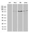 SLU7 Homolog, Splicing Factor antibody, LS-C795669, Lifespan Biosciences, Western Blot image 