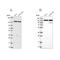 DEAD-Box Helicase 46 antibody, NBP2-56227, Novus Biologicals, Western Blot image 