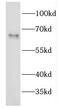 Endonuclease/Exonuclease/Phosphatase Family Domain Containing 1 antibody, FNab02653, FineTest, Western Blot image 