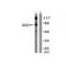 Adducin 1 antibody, A01575, Boster Biological Technology, Western Blot image 