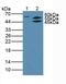 AKT Serine/Threonine Kinase 2 antibody, MBS2006325, MyBioSource, Western Blot image 