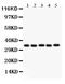 Homeobox A11 antibody, LS-C344067, Lifespan Biosciences, Western Blot image 