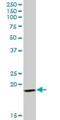 Glycoprotein IX Platelet antibody, H00002815-B01P, Novus Biologicals, Western Blot image 