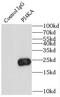 Phosphatidylinositol 4-Kinase Alpha antibody, FNab06426, FineTest, Immunoprecipitation image 