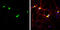 Stromal Interaction Molecule 1 antibody, GTX113558, GeneTex, Immunofluorescence image 