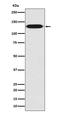 Myosin light chain kinase, smooth muscle antibody, M01697, Boster Biological Technology, Western Blot image 