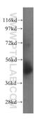 NOP2/Sun RNA Methyltransferase 5 antibody, 15449-1-AP, Proteintech Group, Western Blot image 