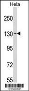 Nuclear Pore Associated Protein 1 antibody, 63-730, ProSci, Western Blot image 