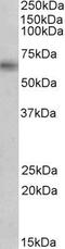 Monoamine Oxidase B antibody, GTX89368, GeneTex, Western Blot image 