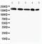 GLI Family Zinc Finger 2 antibody, PA5-79314, Invitrogen Antibodies, Western Blot image 