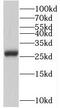 Zinc Ribbon Domain Containing 2 antibody, FNab08251, FineTest, Western Blot image 