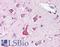 Neurofilament Medium antibody, LS-B258, Lifespan Biosciences, Immunohistochemistry paraffin image 