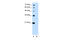 Thyrotroph embryonic factor antibody, ARP38279_P050, Aviva Systems Biology, Western Blot image 