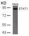 Signal Transducer And Activator Of Transcription 1 antibody, 79-285, ProSci, Western Blot image 