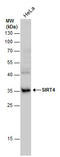 NAD-dependent ADP-ribosyltransferase sirtuin-4 antibody, GTX129978, GeneTex, Western Blot image 