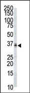 Palmitoyl-Protein Thioesterase 1 antibody, AP12267PU-N, Origene, Western Blot image 