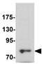 Dynamin 1 Like antibody, GTX31901, GeneTex, Western Blot image 