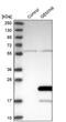Gem Nuclear Organelle Associated Protein 6 antibody, PA5-57376, Invitrogen Antibodies, Western Blot image 