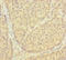 Proteasome Inhibitor Subunit 1 antibody, LS-C371896, Lifespan Biosciences, Immunohistochemistry paraffin image 