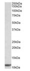 Beta-2-Microglobulin antibody, orb12343, Biorbyt, Western Blot image 