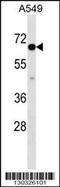 CLPTM1 Like antibody, 58-343, ProSci, Western Blot image 