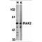 Interleukin-1 receptor-associated kinase-like 2 antibody, TA305997, Origene, Western Blot image 