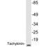 Tachykinin Precursor 1 antibody, LS-C200016, Lifespan Biosciences, Western Blot image 