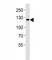 Janus Kinase 2 antibody, F52602-0.4ML, NSJ Bioreagents, Western Blot image 