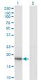 KiSS-1 Metastasis Suppressor antibody, H00003814-M05, Novus Biologicals, Western Blot image 