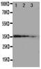 Matrilin 2 antibody, PA5-79634, Invitrogen Antibodies, Western Blot image 