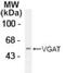 Solute Carrier Family 32 Member 1 antibody, NB300-740, Novus Biologicals, Western Blot image 